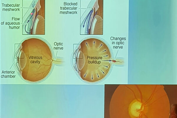 seminario-hmerida-eao-20h-xamhlh-orash-low-vision-2024-05-19-08