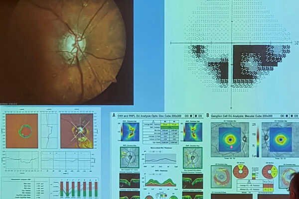 seminario-hmerida-eao-20h-xamhlh-orash-low-vision-2024-05-19-10